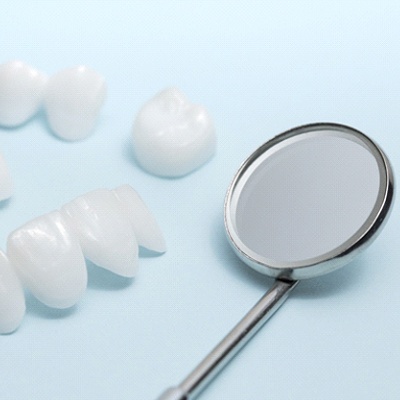 All-ceramic dental bridges and dental crown before placement